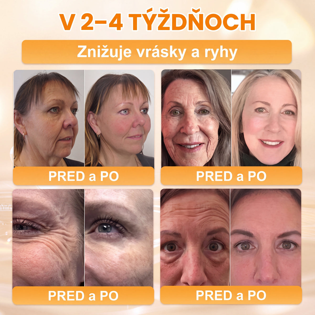 Vyrobené na Slovensku 🐝 𝖠𝖯𝖪𝖠𝖯𝖪® regeneračný krém na pokožku s včelím jedom